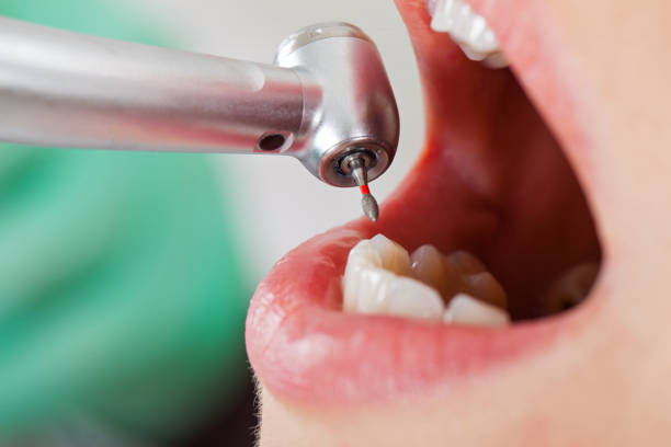 Best Emergency Treatment for Oral Infections in Orcdlands Estates, HI